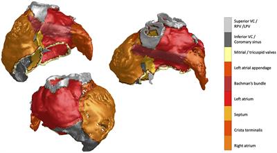 Interactive teaching of medical 3D cardiac anatomy: atrial anatomy enhanced by ECG and 3D visualization